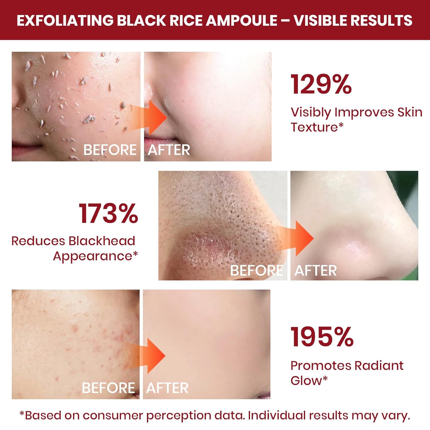 Exfoliating Rice Peel Shot Face Serum & Body Scrub, Black Rice & White Rice Ampoule, Removes Dead Skin Cells and Blackheads, Gentle Glow Peeling for All Skin Types